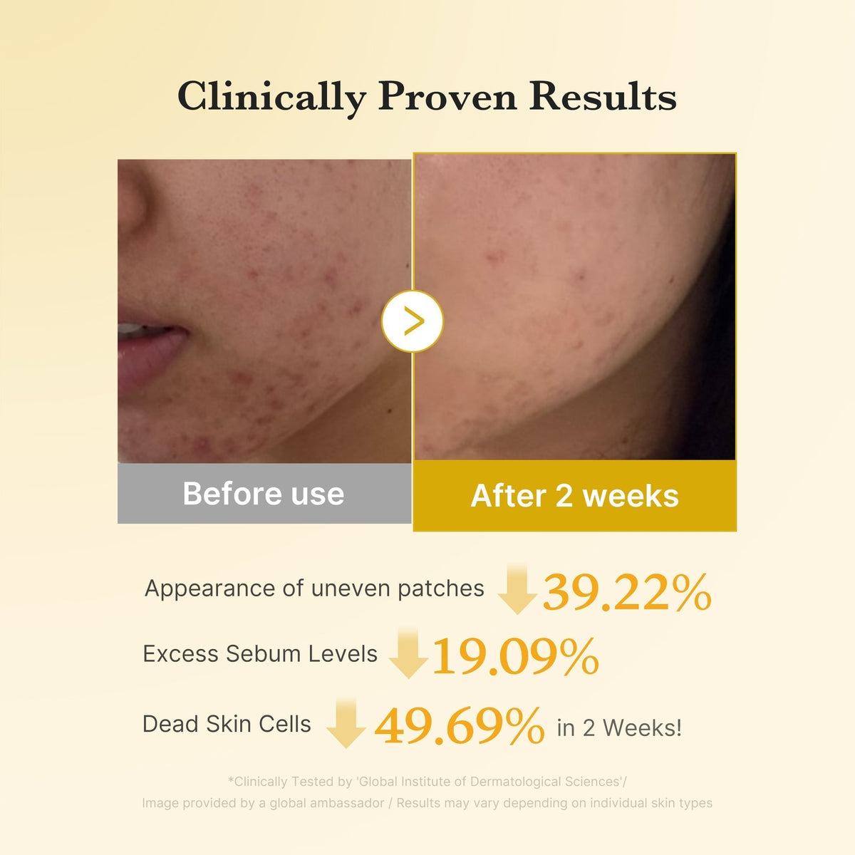 Kojic Turmeric Brightening Set