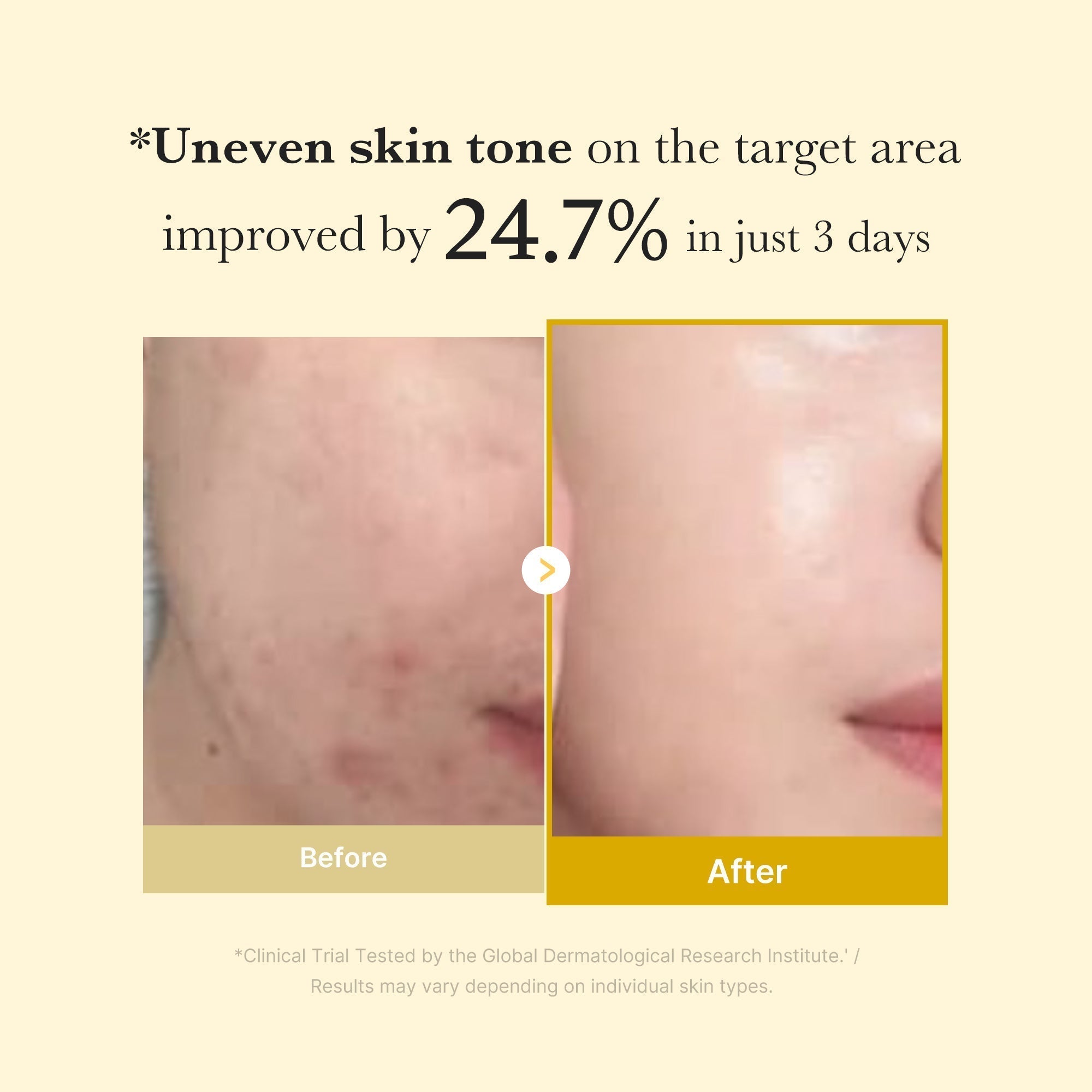 Kojic Turmeric Brightening Set